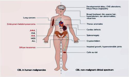 Oncological Diseases