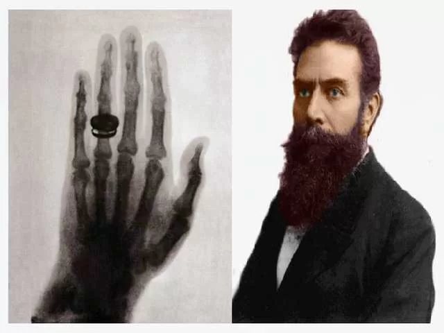 X-Rays Wilhelm Roentgen