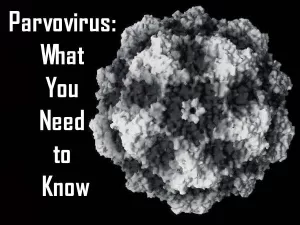 Parvovirus